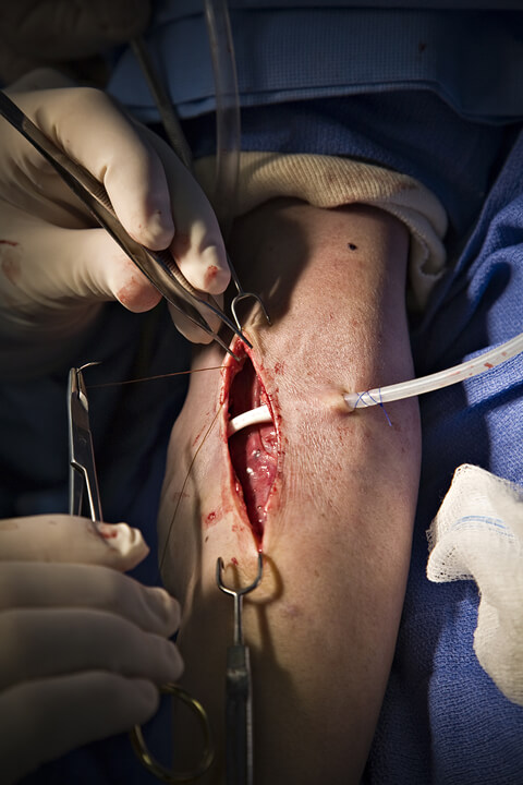 Oblique-(suture)-panel 3-2008