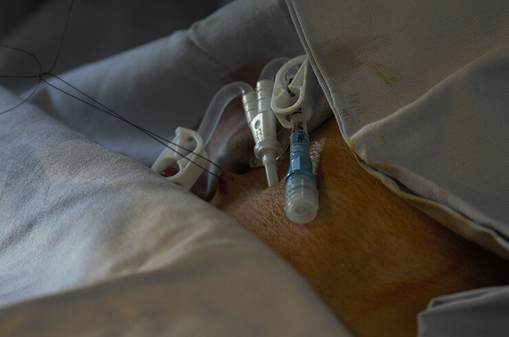 Insertion of catheter for hemodialysis, from the project “The Blood Tree” (2017). Photo: Herani Enríquez